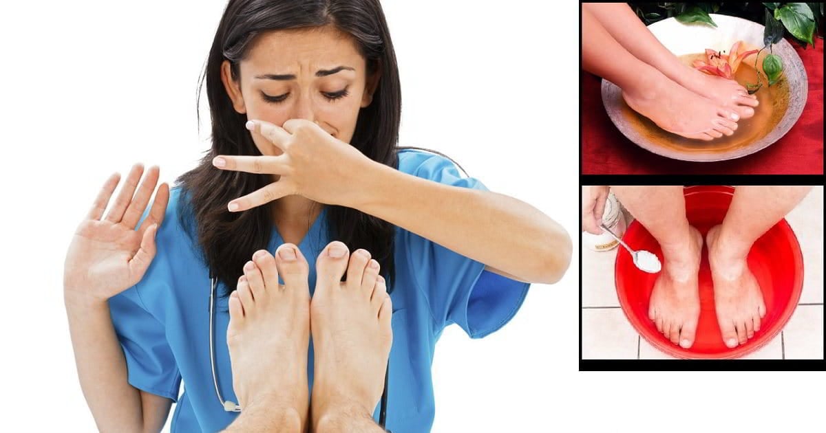 Como Quitar El Desteñido De Los Pies